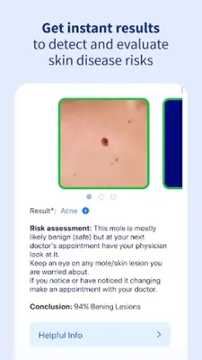 AI Dermatologist Skin Scanner android App screenshot 4